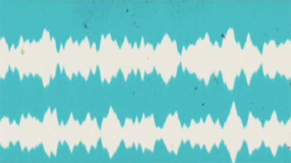 Two white sound waves on a light teal background. The image is slightly out of focus and speckled.